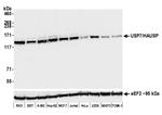 USP7 Antibody in Western Blot (WB)