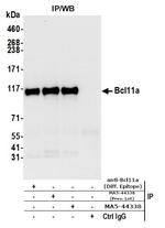BCL11A Antibody in Immunoprecipitation (IP)