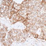 CD155 Antibody in Immunohistochemistry (Paraffin) (IHC (P))