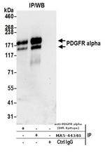 CD140a (PDGFRA) Antibody in Immunoprecipitation (IP)