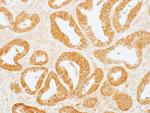 MEK2 Antibody in Immunohistochemistry (Paraffin) (IHC (P))