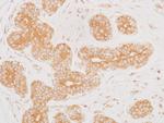 MEK2 Antibody in Immunohistochemistry (Paraffin) (IHC (P))