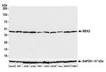 MEK2 Antibody in Western Blot (WB)