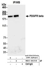 CD140b (PDGFRB) Antibody in Immunoprecipitation (IP)
