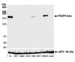 CD140b (PDGFRB) Antibody in Western Blot (WB)