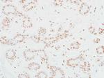 MED12 Antibody in Immunohistochemistry (Paraffin) (IHC (P))