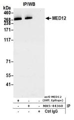 MED12 Antibody in Immunoprecipitation (IP)