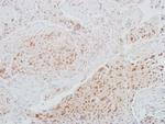 CDK1 Antibody in Immunohistochemistry (Paraffin) (IHC (P))