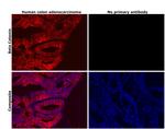 beta Catenin Antibody in Immunohistochemistry (Paraffin) (IHC (P))