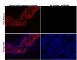 beta Catenin Antibody in Immunohistochemistry (Paraffin) (IHC (P))