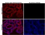 beta Catenin Antibody in Immunohistochemistry (Paraffin) (IHC (P))