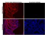 beta Catenin Antibody in Immunohistochemistry (Paraffin) (IHC (P))