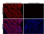 beta Catenin Antibody in Immunohistochemistry (Paraffin) (IHC (P))