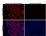 beta Catenin Antibody in Immunohistochemistry (Paraffin) (IHC (P))