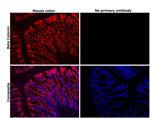 beta Catenin Antibody in Immunohistochemistry (Paraffin) (IHC (P))