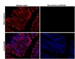 beta Catenin Antibody in Immunohistochemistry (Paraffin) (IHC (P))