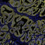 beta Catenin Antibody in Immunohistochemistry (Paraffin) (IHC (P))