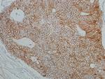 beta Catenin Antibody in Immunohistochemistry (Paraffin) (IHC (P))