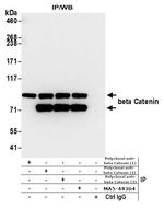 beta Catenin Antibody in Immunoprecipitation (IP)