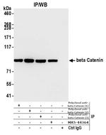 beta Catenin Antibody in Immunoprecipitation (IP)