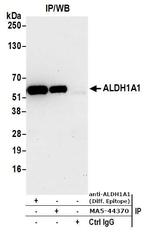 ALDH1A1 Antibody in Immunoprecipitation (IP)