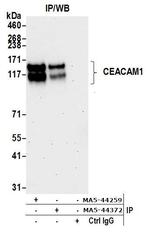 CD66a (CEACAM1) Antibody in Immunoprecipitation (IP)