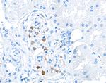 ZO-1 Antibody in Immunohistochemistry (Paraffin) (IHC (P))