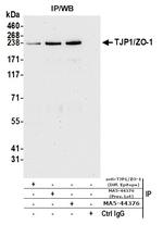 ZO-1 Antibody in Immunoprecipitation (IP)