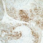 Claudin 1 Antibody in Immunohistochemistry (Paraffin) (IHC (P))