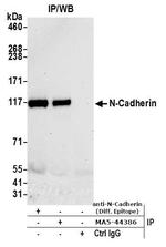 CD325 (N-Cadherin) Antibody in Immunoprecipitation (IP)