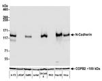 CD325 (N-Cadherin) Antibody in Western Blot (WB)