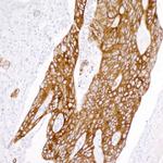 Cytokeratin 20 Antibody in Immunohistochemistry (Paraffin) (IHC (P))