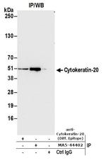 Cytokeratin 20 Antibody in Immunoprecipitation (IP)