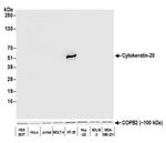 Cytokeratin 20 Antibody in Western Blot (WB)