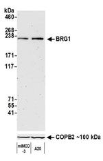 BRG1 Antibody in Western Blot (WB)