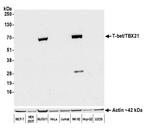 T-bet Antibody in Western Blot (WB)