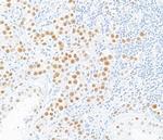 MLH1 Antibody in Immunohistochemistry (Paraffin) (IHC (P))