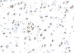 MSH2 Antibody in Immunocytochemistry (ICC/IF)