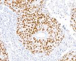 MSH2 Antibody in Immunohistochemistry (Paraffin) (IHC (P))