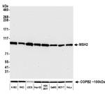 MSH2 Antibody in Western Blot (WB)