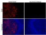 CD38 Antibody in Immunohistochemistry (Paraffin) (IHC (P))