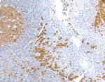 CD38 Antibody in Immunohistochemistry (Paraffin) (IHC (P))