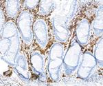 CD38 Antibody in Immunohistochemistry (Paraffin) (IHC (P))