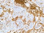 CD38 Antibody in Immunohistochemistry (Paraffin) (IHC (P))