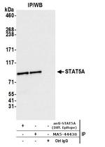 STAT5 alpha Antibody in Immunoprecipitation (IP)