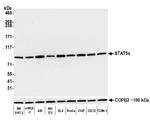 STAT5 alpha Antibody in Western Blot (WB)