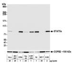 STAT5 alpha Antibody in Western Blot (WB)