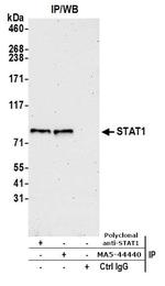 STAT1 Antibody in Immunoprecipitation (IP)