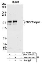 CD140a (PDGFRA) Antibody in Immunoprecipitation (IP)