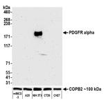 CD140a (PDGFRA) Antibody in Western Blot (WB)